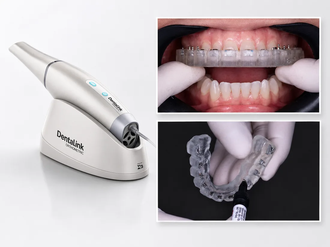 Scanner intraoral e fluxo de ortodontia digital